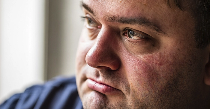 Мужчина с отекшим лицом